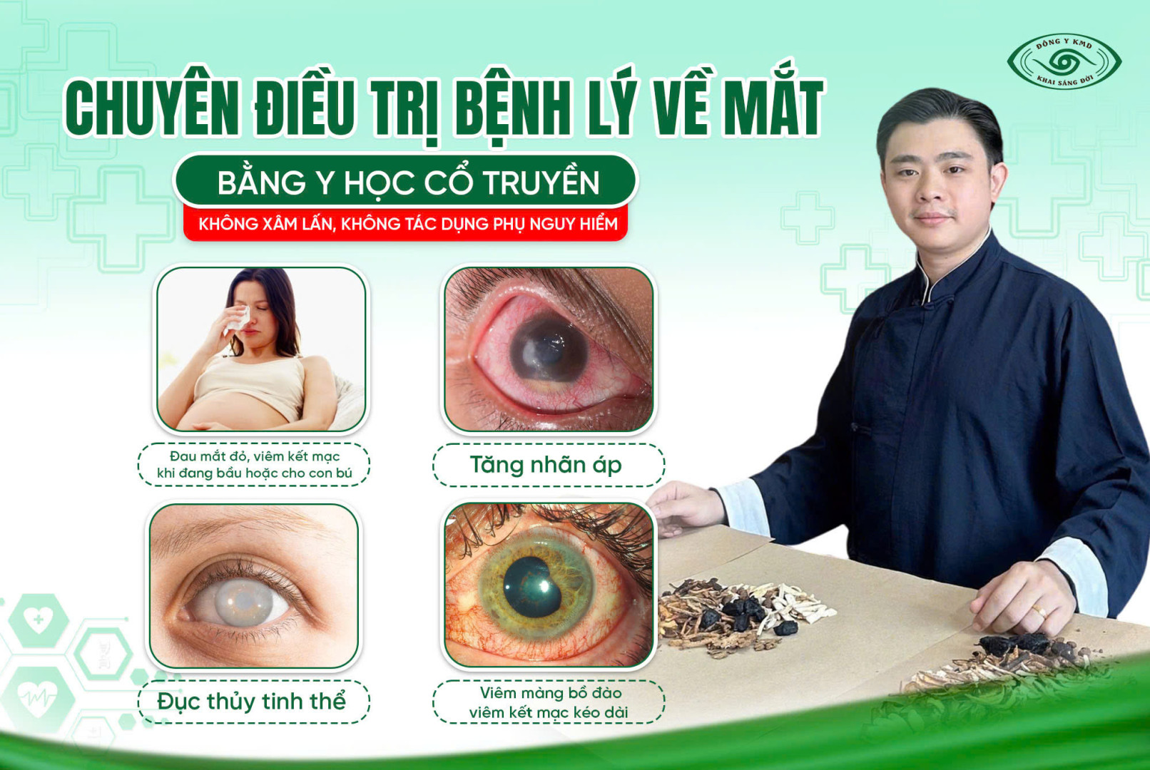 Dieu Tri Benh Ly Ve Mat Bang Y Hoc Co Truyen