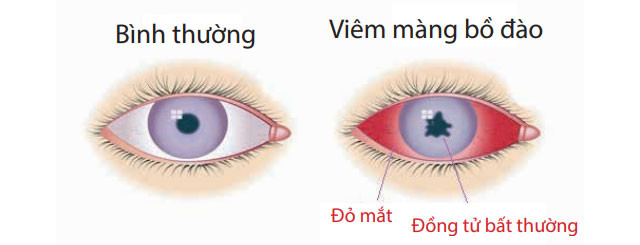 Viem Mang Bo Dao