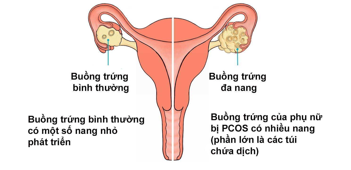 Buong Trung Da Nang