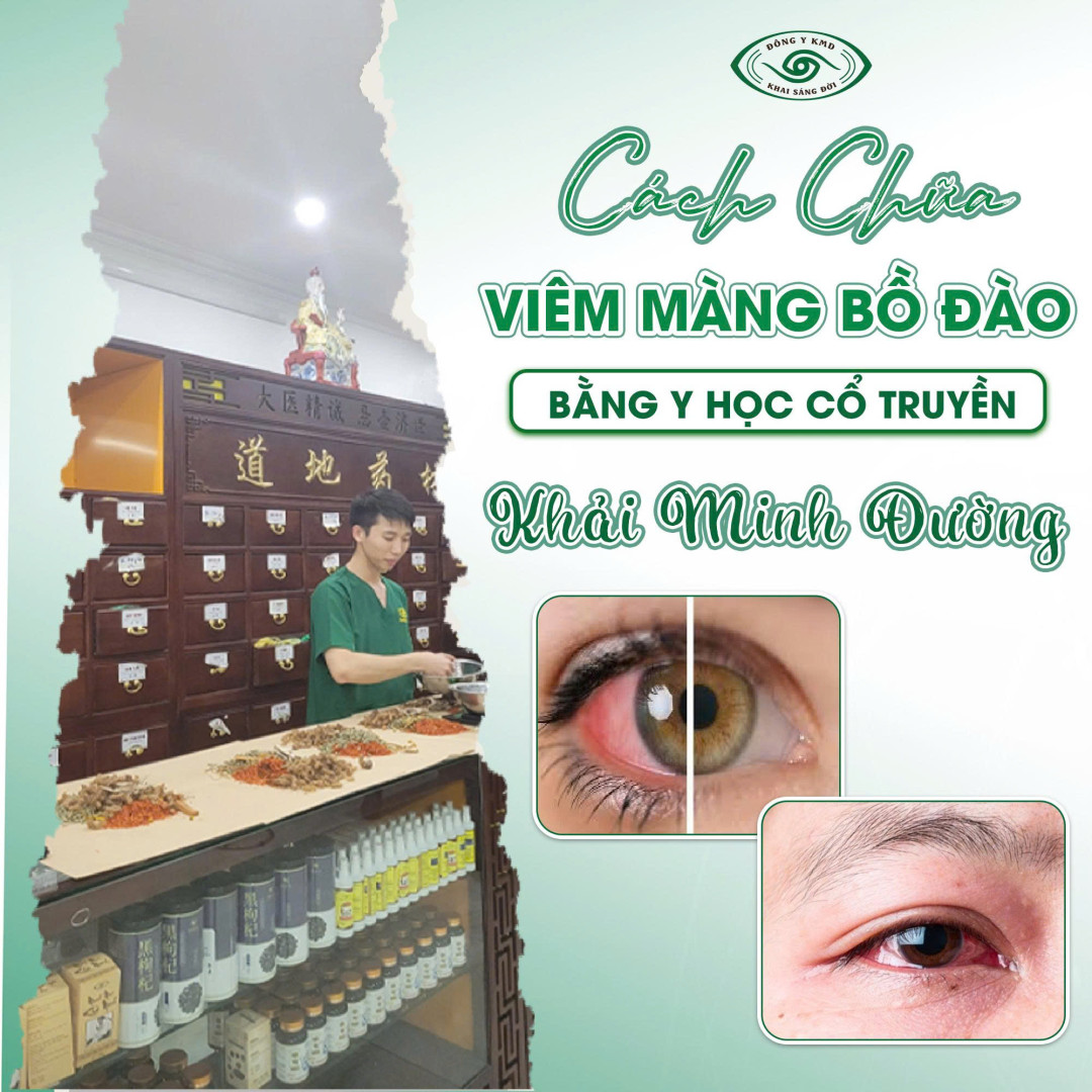 Cach Chua Viem Mang Bo Dao Bang Y Hoc Co Truyen