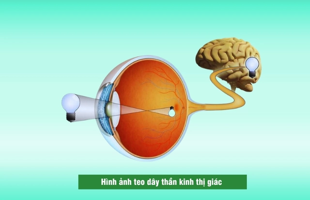 Teo Than Kinh Thi Giac