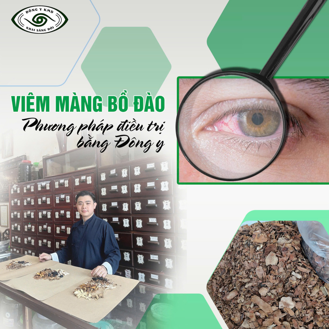 Viem Mang Bo Dao Phuong Phap Dieu Tri Bang Dong Y