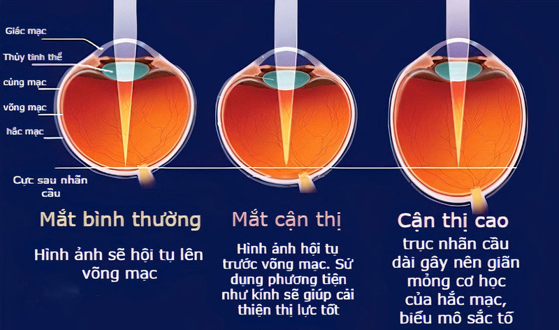 An Thi Nang
