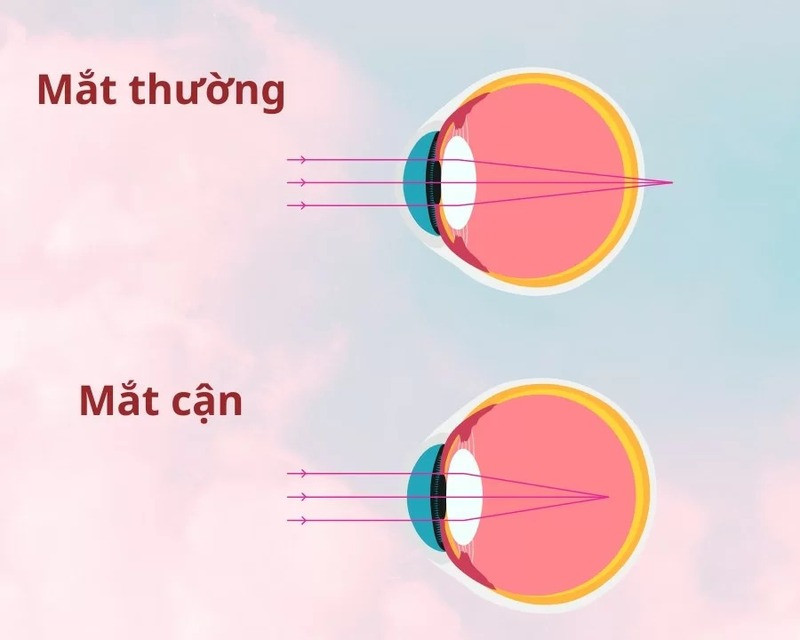 Mat Thuong Va Mat Can