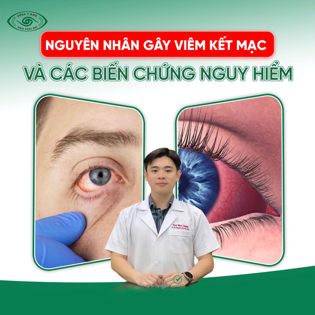 Nguyen Nhan Gay Viem Ket Mac Va Cac Bien Chung Nguy Hiem