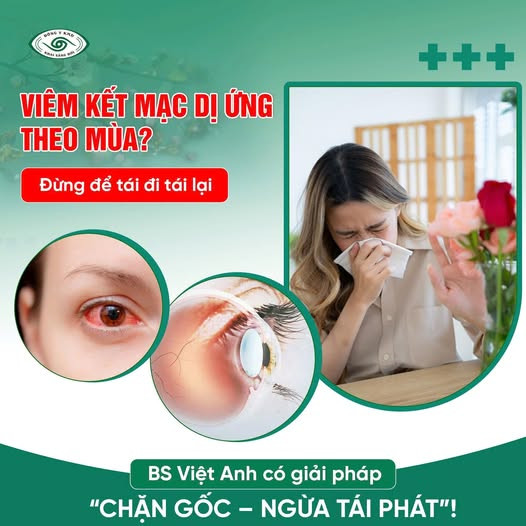Viem Ket Mac Di Ung Theo Mua