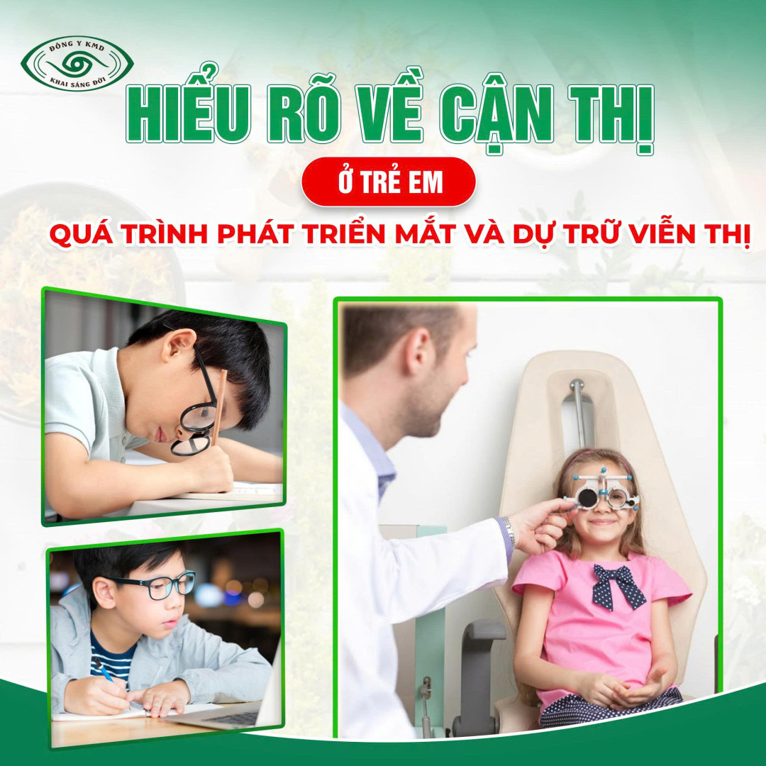 Hieu Ro Ve Can Thi O Tre Em Qua Trinh Phat Trien Mat Va Du Tru Vien Thi